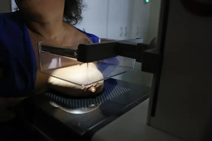 ANS defende que plano cubra mamografia digital sem restrição de idade