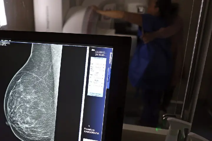 Médicos lançam guia para evitar recusa de mamografia digital