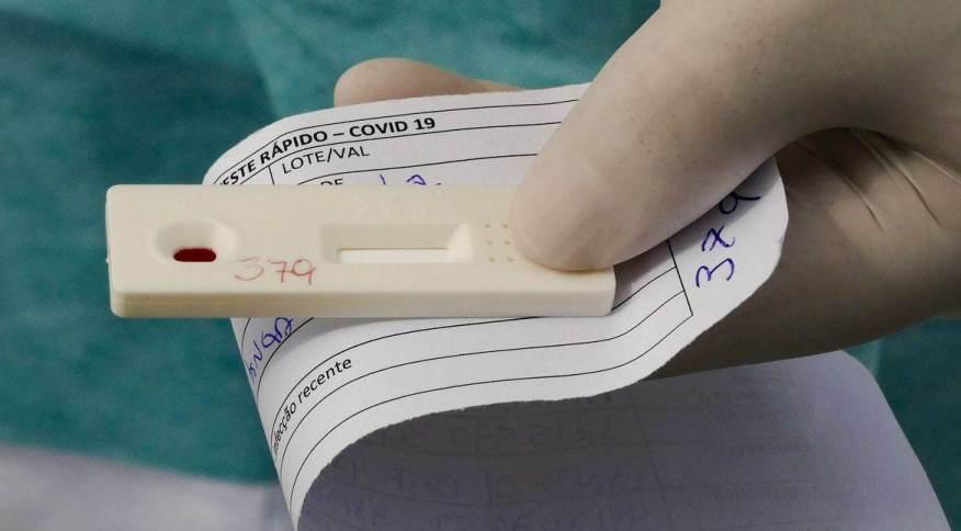 Virús da gripe preocupa e já faltam testes na rede pública da região