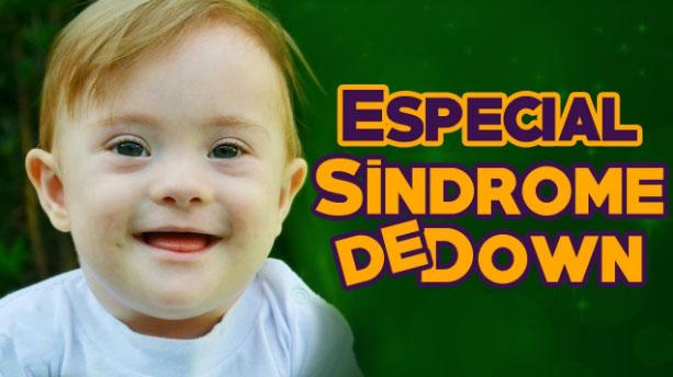 Entenda sobre a Síndrome de Down